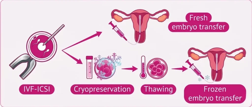 Frozen Embryo Transfers